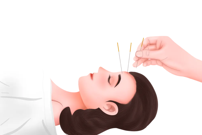 Healing Through Acupuncture: A Powerful Option for Pain Relief